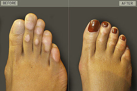 cinderella surgery1 6068 1404093551 m 460x0