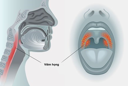 viem hong