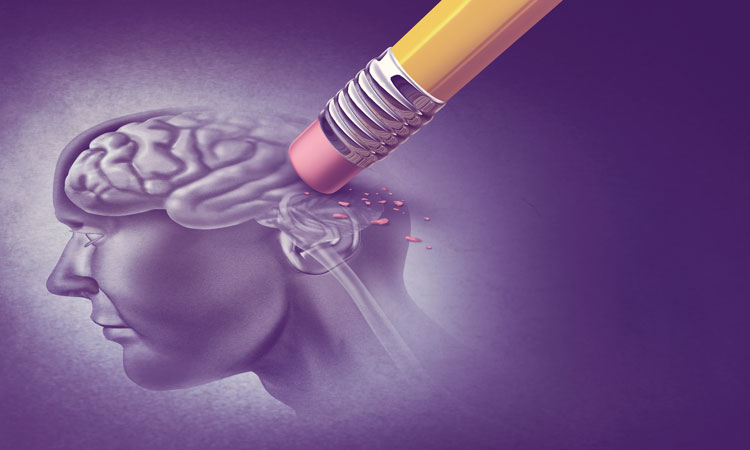 Alzheimers