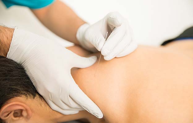 dry needling in sydney cbd