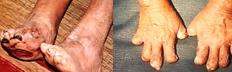 hanmactu1