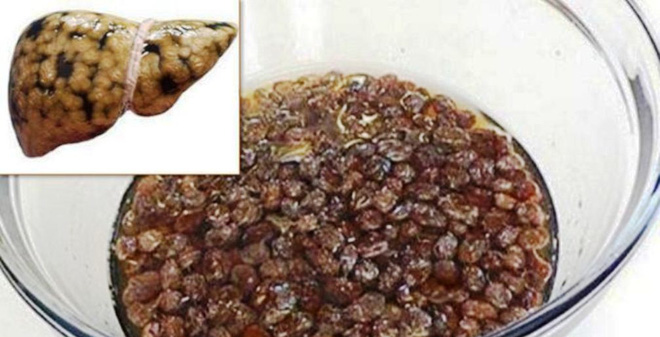 how to cleanse your liver with raisins and water